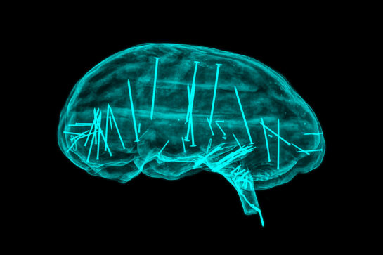 Cerveau_1_A_01